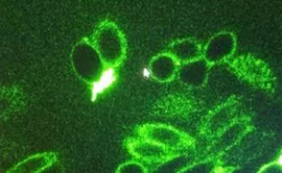 荧光共振能量转移（Fluorescence resonance energy transfer, FRET)